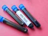 the new therapy uses exosomes to carry cas12a into cells to accurately locate the hiv virus including latent hiv and shreds its genome achieving a functional cure for aids photo pexels