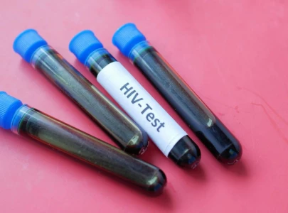 chinese scientists develop targeted gene editing system aiming for new hiv cure