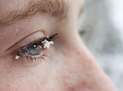 5 ways to protect your eyes in winter