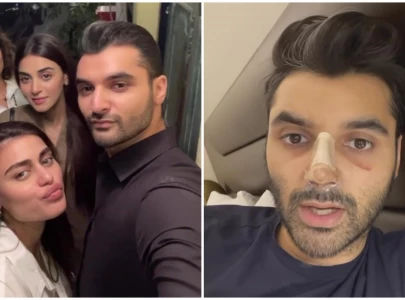 why hide it celebrated mua omayr waqar walks everyone through his cosmetic surgery