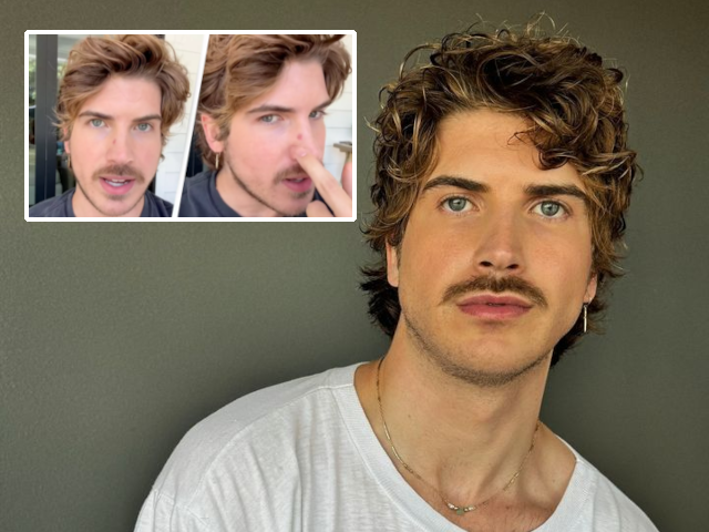 YouTuber Joey Graceffa نے جلد کے کینسر کے علاج کے بارے میں غلط معلومات پھیلانے پر تنقید کی۔