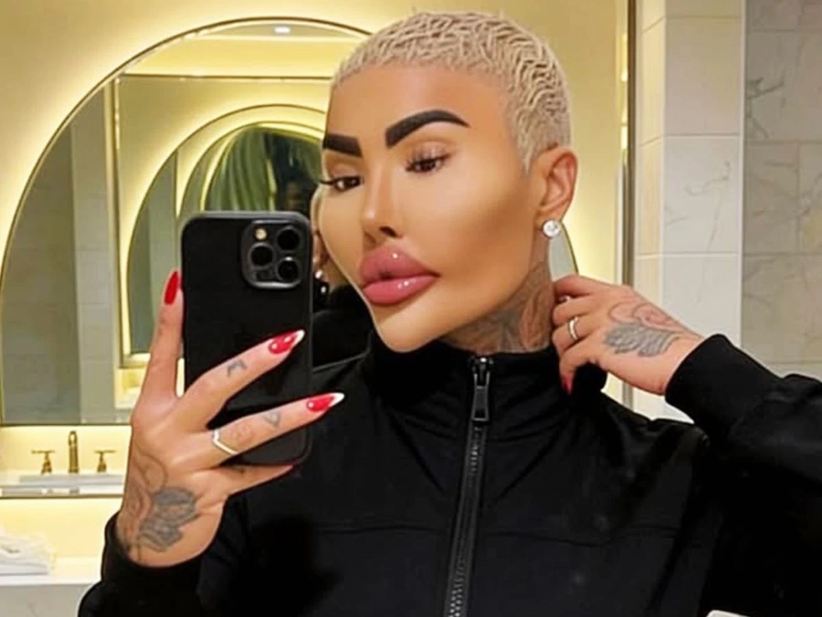 botched star jordan james parke found dead at 34 investigation and arrests follow