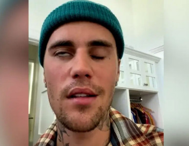 justin bieber suffering from partial face paralysis justin bieber suffering from partial face paralysis