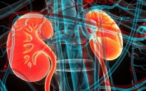 karachi heatwave triggers surge in kidney infections say medical experts karachi heatwave triggers surge in kidney infections say medical experts