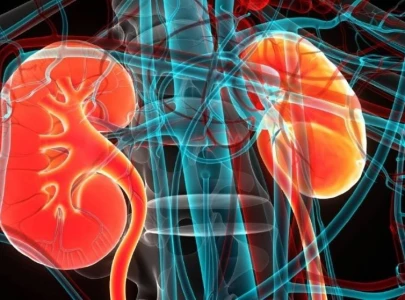 karachi heatwave triggers surge in kidney infections say medical experts karachi heatwave triggers surge in kidney infections say medical experts