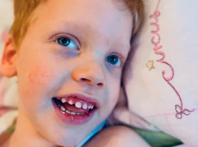 child influencer jelte dies at 5 after battle with rare genetic disorder