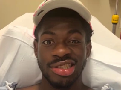 lil nas x hospitalized after sudden facial paralysis on right side