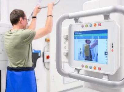 ai equipped x ray machine installed at qatar hospital ai equipped x ray machine installed at qatar hospital