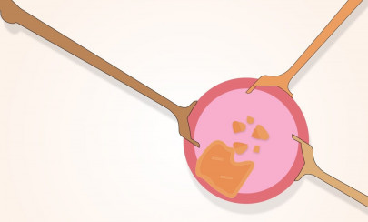 unequipped to feed the under fed