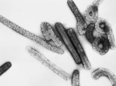 marburg virus what you need to know about the ebola like disease spreading in rwanda