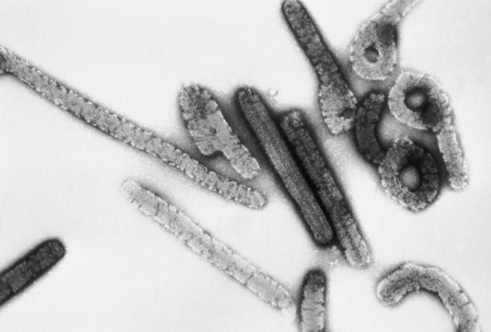 a micrograph marburg virus photo wikimedia commons