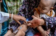 a child receives a dose of measles rubella vaccine in dhaka on april 12 photo afp