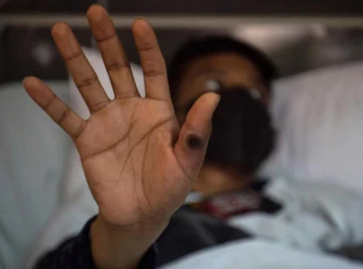 govt swings into action after mpox alert