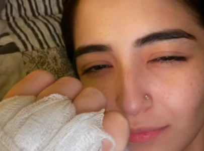 merub ali undergoes trigger finger surgery shares recovery journey