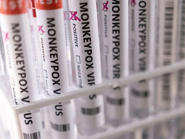 test tubes labelled monkeypox virus positive are seen in this illustration taken may 22 2022 photo reuters test tubes labelled monkeypox virus positive are seen in this illustration taken may 22 2022 photo reuters