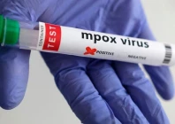 k p reported first locally transmitted mpox case photo file