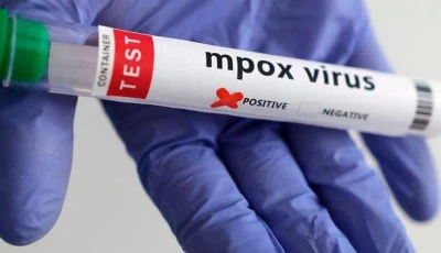 mpox resurfaces as man daughter among 3 new cases mpox resurfaces as man daughter among 3 new cases
