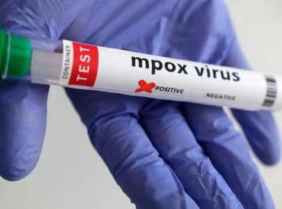 suspected mpox case reported in karachi suspected mpox case reported in karachi