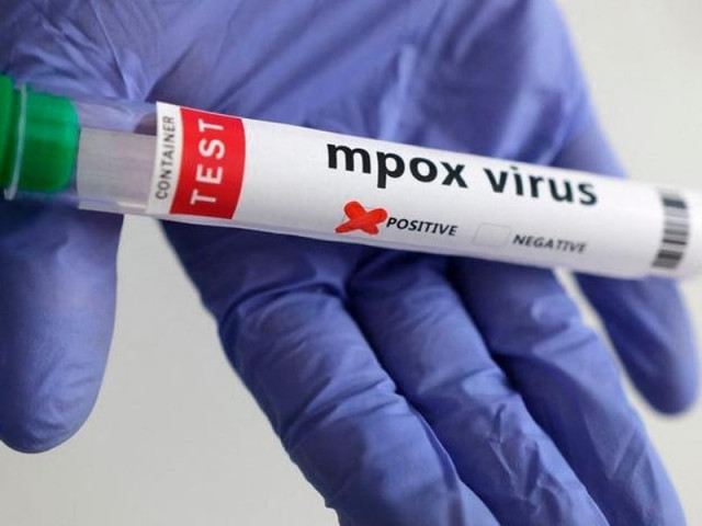 k p reported first locally transmitted mpox case photo file k p reported first locally transmitted mpox case photo file