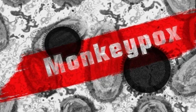 the image shows mpox micrograph in the background photo pixabay