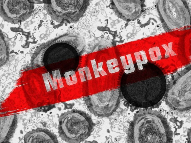the image shows mpox micrograph in the background photo pixabay the image shows mpox micrograph in the background photo pixabay