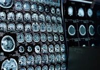 ct scan mri machines lying defunct at govt run hospitals ct scan mri machines lying defunct at govt run hospitals