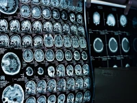 ct scan mri machines lying defunct at govt run hospitals ct scan mri machines lying defunct at govt run hospitals