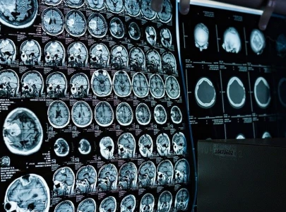 ct scan mri machines lying defunct at govt run hospitals ct scan mri machines lying defunct at govt run hospitals