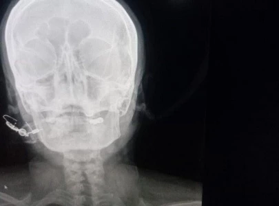 fake peer hammers nail into woman s skull in peshawar