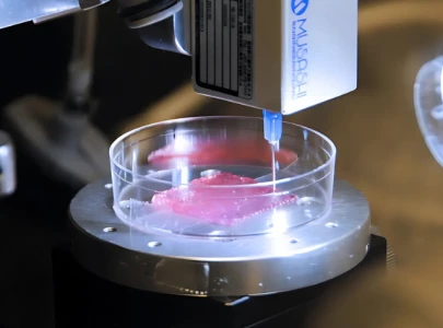 is this the future of medicine ultrasound based 3d printing could replace surgeries is this the future of medicine ultrasound based 3d printing could replace surgeries