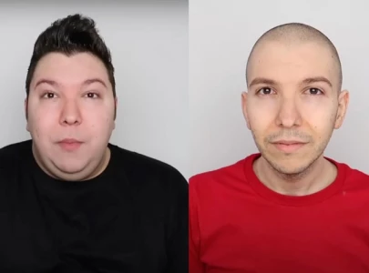 nikocado avocado reveals facelift transformation after 250 lb weight loss nikocado avocado reveals facelift transformation after 250 lb weight loss