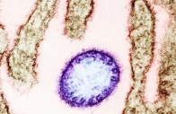 colorized transmission electron micrograph of a mature extracellular nipah virus particle purple near the periphery of an infected vero cell brown image captured and color enhanced at the niaid integrated research facility in fort detrick maryland credit niaid wikimedia commons