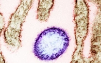 k p issues province wide alert over possible nipah virus threat k p issues province wide alert over possible nipah virus threat