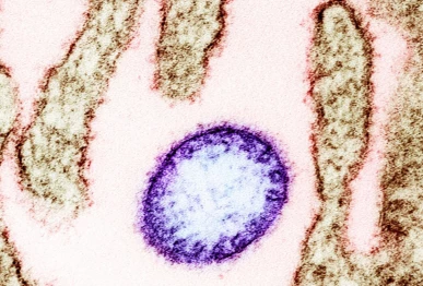 colorized transmission electron micrograph of a mature extracellular nipah virus particle purple near the periphery of an infected vero cell brown image captured and color enhanced at the niaid integrated research facility in fort detrick maryland credit niaid wikimedia commons