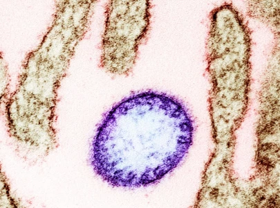 k p issues province wide alert over possible nipah virus threat k p issues province wide alert over possible nipah virus threat