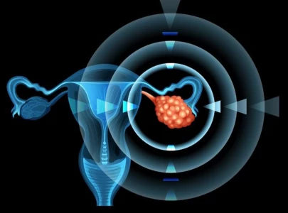 world s first ovarian cancer vaccine could eliminate deadly disease