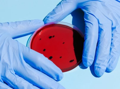 doctors concern over infection diseases vaccination gap in sindh doctors concern over infection diseases vaccination gap in sindh