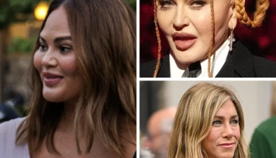pillow face is the latest celebrity cosmetic surgery fail check it out