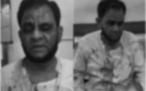 ku senior professor allegedly assaulted detained after minor traffic dispute
