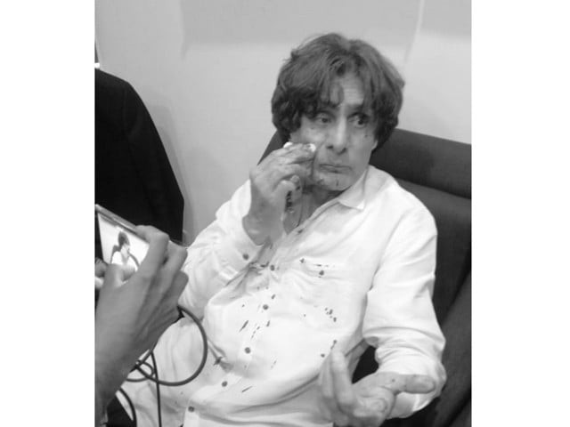 raoof hasan attacked by transgender persons raoof hasan attacked by transgender persons