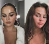 selena gomez shares different faces and phases after denying cosmetic surgery rumours