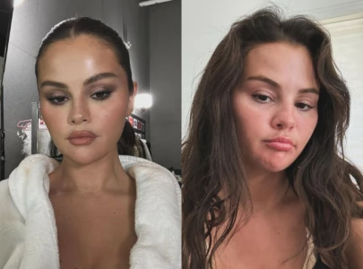 selena gomez shares different faces and phases after denying cosmetic surgery rumours