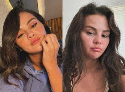 selena gomez reveals cosmetic procedure i have botox that s it