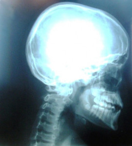 tv anchor murder case autopsy confirms head injury tv anchor murder case autopsy confirms head injury