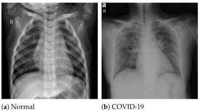 game changing ai technology can detect covid 19 in minutes