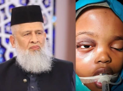 successful surgery saves somali girl