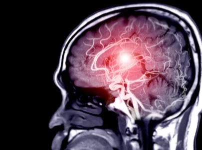 ucla scientists create drug that restores movement after stroke ucla scientists create drug that restores movement after stroke