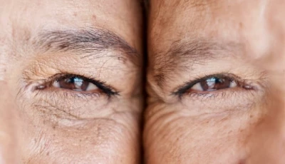 the secret to lessen fine lines a simple diy mask you can make at home