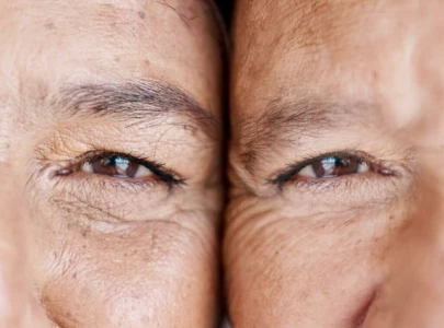 the secret to lessen fine lines a simple diy mask you can make at home the secret to lessen fine lines a simple diy mask you can make at home