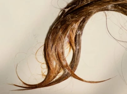 struggling with hair fall 6 health issues that could be behind the breakage